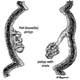 ポリポーシス大腸 - 写真