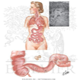 胃腸の結核 - 写真